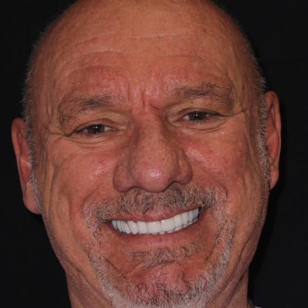 Danny James