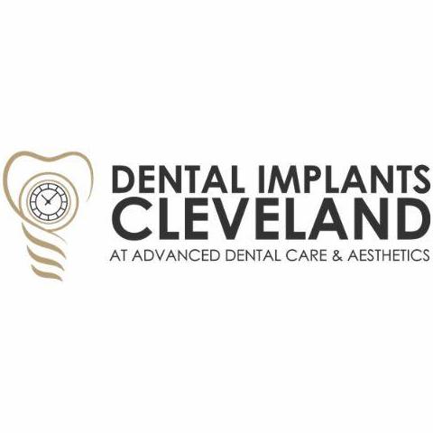 Dental Implants   Cleveland